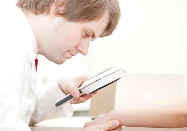 Diagnóza psoriázy dermatológom