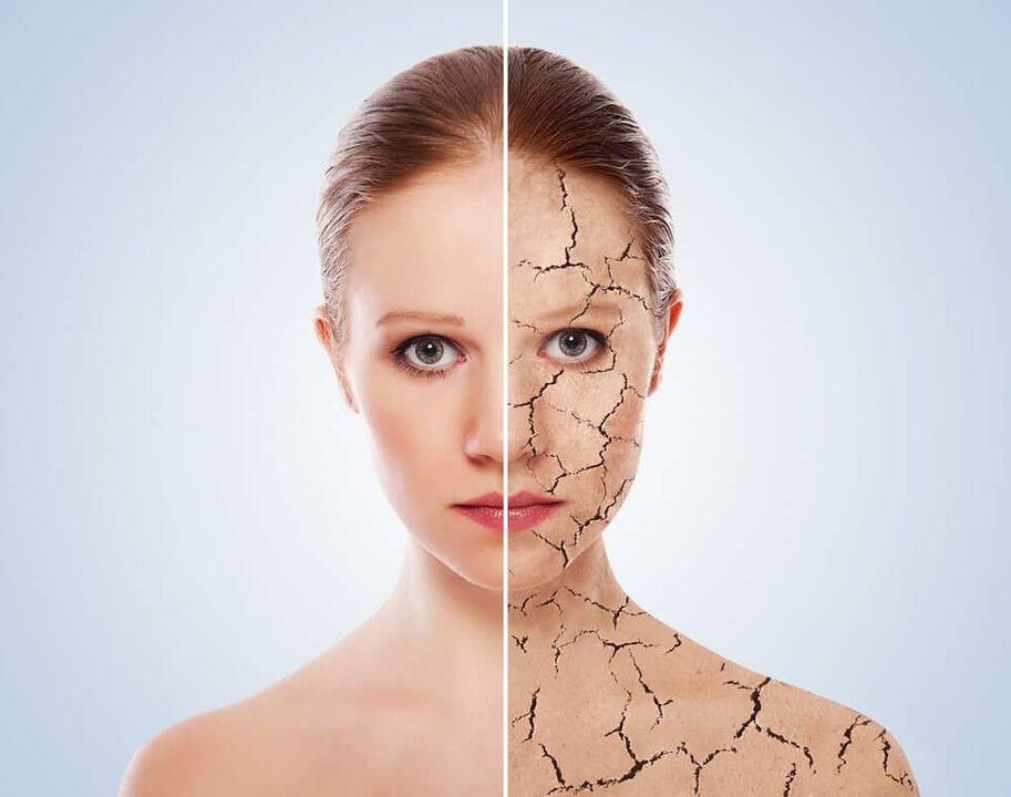 Zdravá pokožka a pokožka postihnutá psoriázou